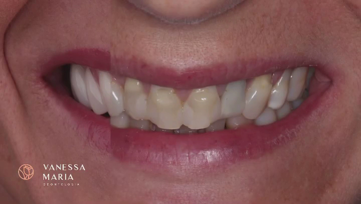Foto 3 de Clínica Vanessa Maria Odontologia | Dentista Maringá | Clínica Odontológica | Implantodontia e Periodontia