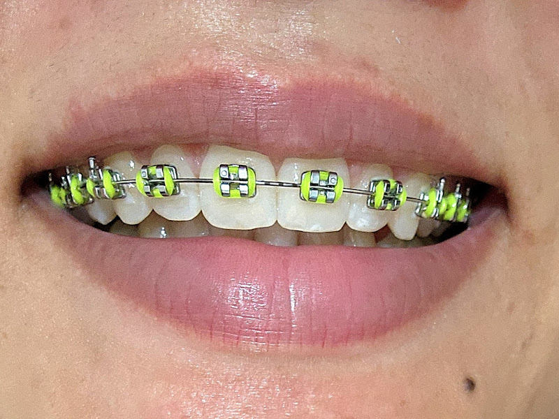 Foto 8 de Clínica Venha Sorrir Filial