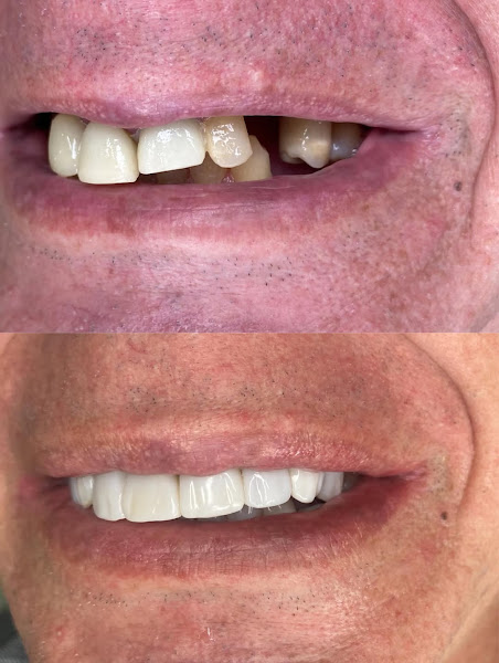 Foto 3 de Clínica Verodonto - Facetas e Implantes em Itaquaquecetuba | Dr. Wellington C. Gomes