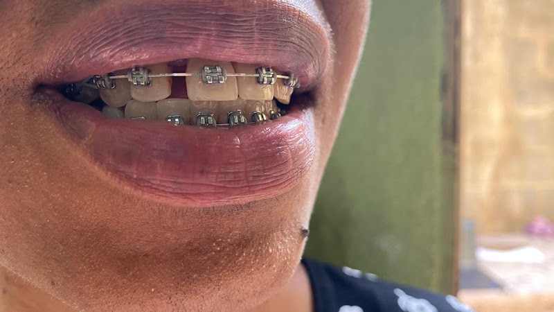 Foto 3 de Clínica Via Implantes