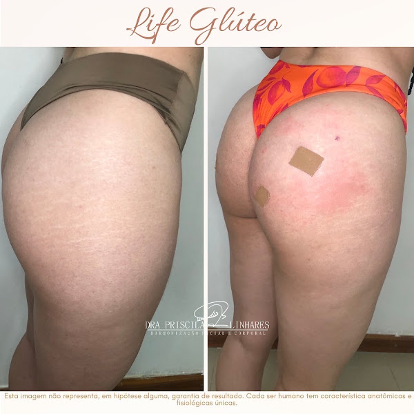Foto 2 de Clínica Vida Saúde e estética - Dra Priscila Linhares