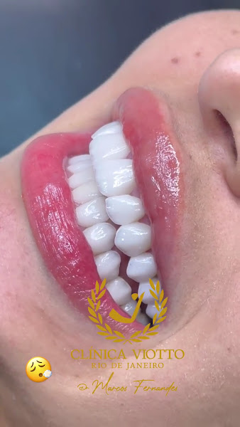 Foto 4 de Clínica Viotto Rio de Janeiro