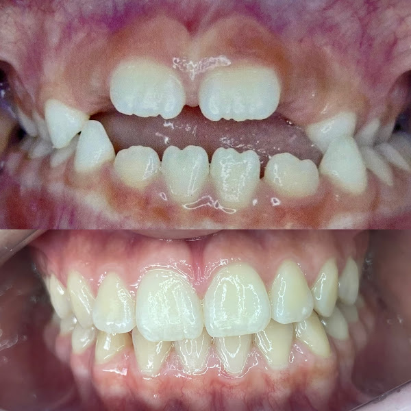 Foto 3 de Clínica VisaYou Odontologia | Dra. Lode Abreu