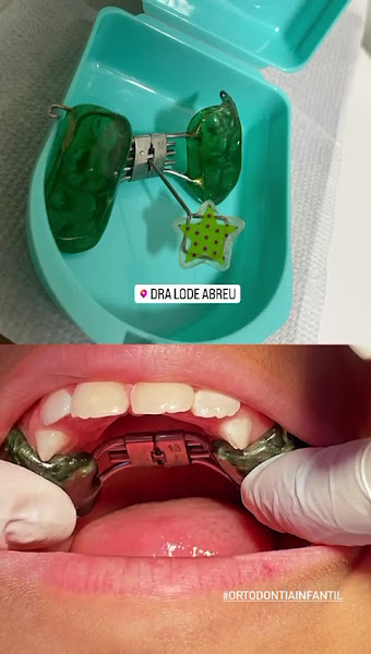 Foto 4 de Clínica VisaYou Odontologia | Dra. Lode Abreu