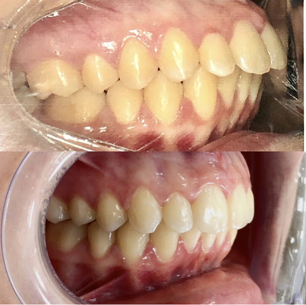 Foto 3 de Clínica Vitale Saúde Integrativa - Odontologia, Ortodontia e Harmonização facial