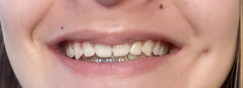 Foto 3 de Clínica Vitta Odontologia