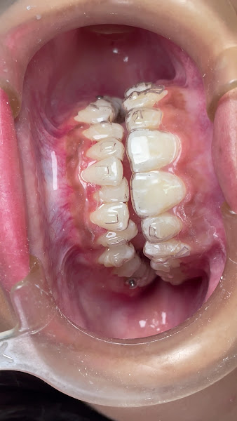 Foto 4 de Clínica Vivere Odontologia - Dentista em Lages