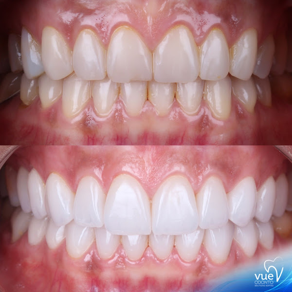 Foto 2 de Clínica Vue Odonto