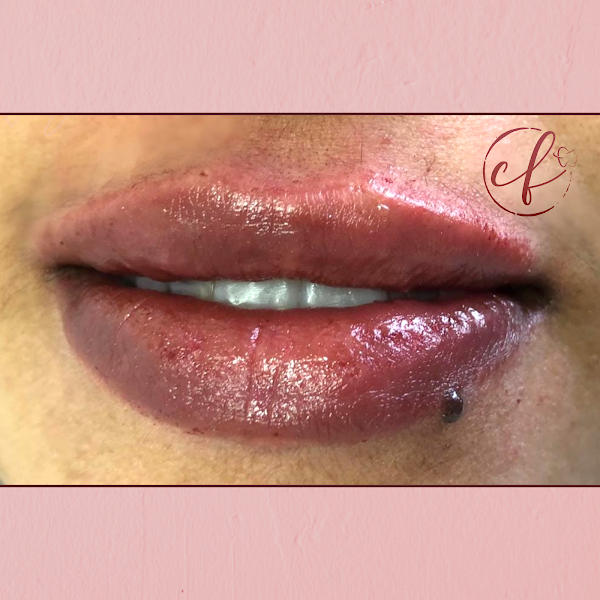 Foto 2 de Clinical Face