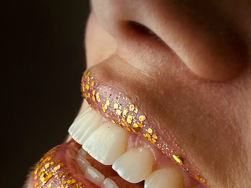 Foto 7 de CLINICAL FACE Odontologia e Harmonização Orofacial