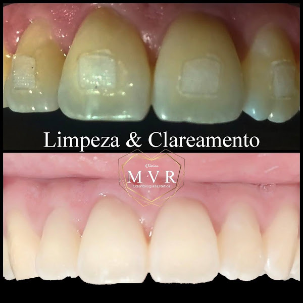 Foto 2 de clinicaMVR