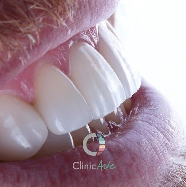 Foto 2 de ClinicArte | Dr Mayer Beinisch