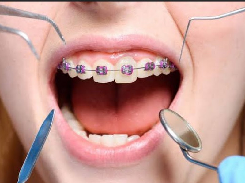 Foto 6 de Clínicas Benjamim - Unidade Aracapé