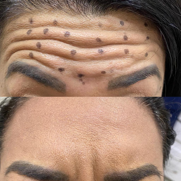 Foto 3 de Clínicas Implante Fácil by Dr. Mike - Unidade Vieralves