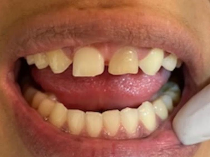 Foto 11 de CliniCler Odontologia| Invisalign