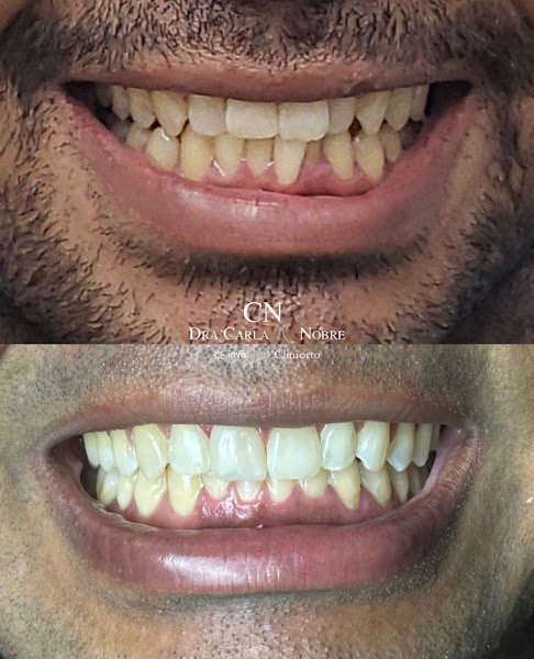 Foto 3 de Cliniorto I Dra. Carla R Nobre - Top Doctor I Excelência em Ortodontia com Alinhadores - ESTACIONAMENTO EXCLUSIVO em frente!