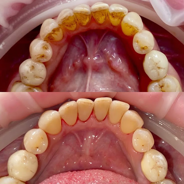 Foto 3 de ClínPro Odontologia