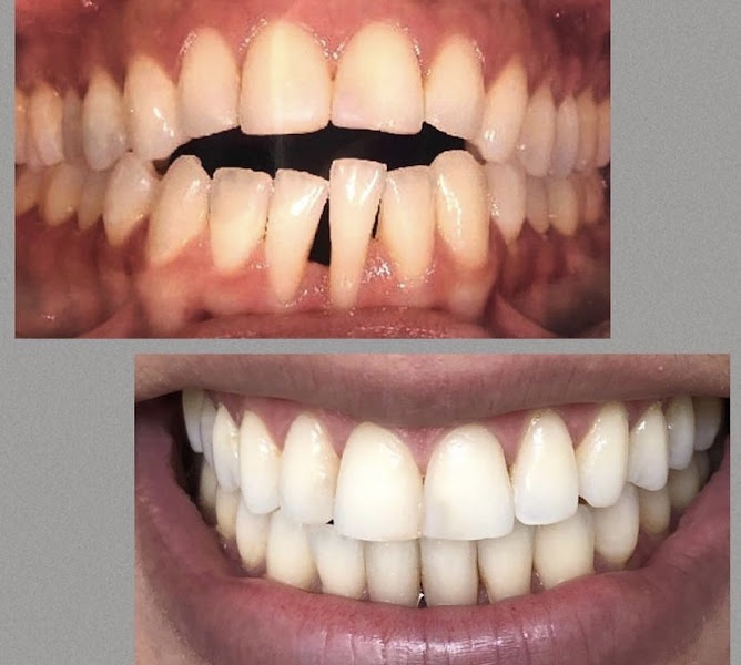 Foto 2 de ClinSmile Odontologia