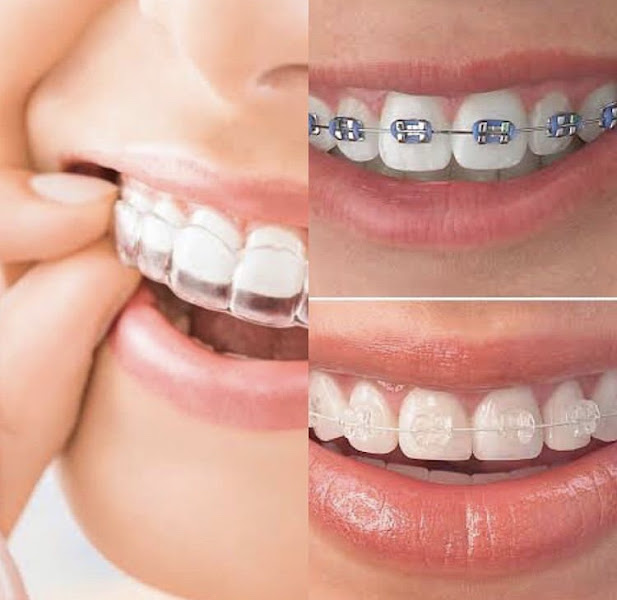 Foto 3 de ClinSmile Odontologia