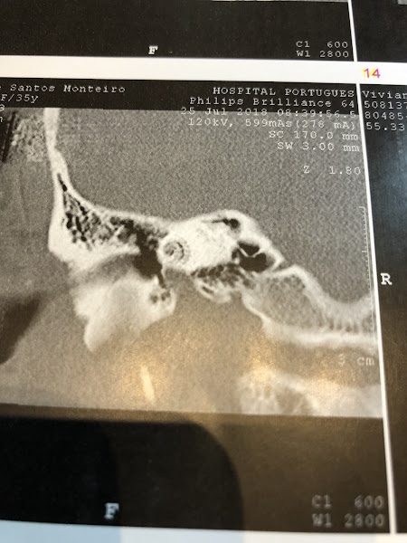 Foto 2 de Clioc Clínica Otorrinolaringologia