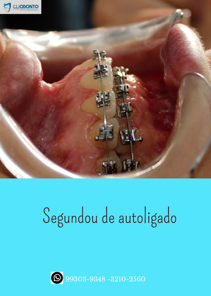 Foto 3 de CLIODONTO | DENTISTA EM PORTO VELHO - RO