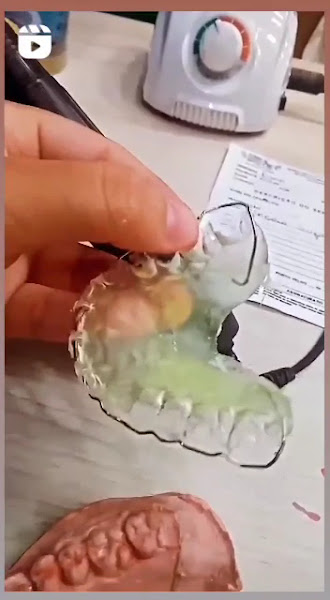 Foto 4 de CLIODONTO | DENTISTA EM PORTO VELHO - RO