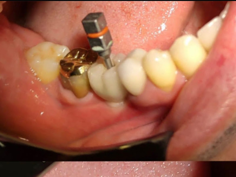 Foto 8 de CMEO Odontologia | Implantes Dentários | Dentista na Lapa