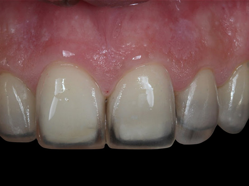 Foto 8 de COEP - Centro Odontológico Especializado de Pernambuco | Implantes Dentários e Reabilitação Oral