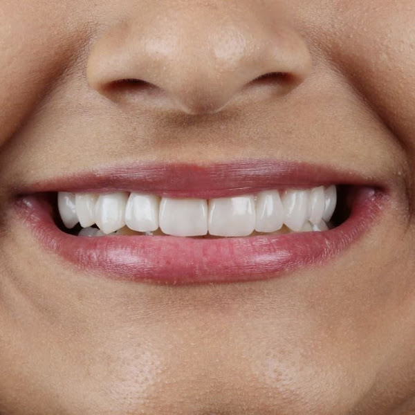 Foto 3 de Coife Odonto