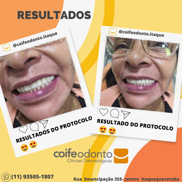 Foto 4 de Coife Odonto Itaquaquecetuba