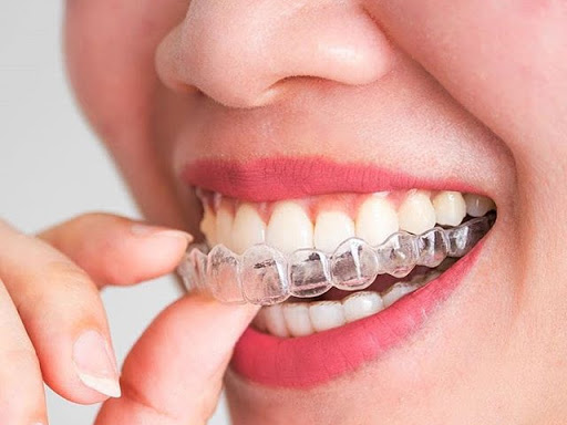 Foto 3 de Coife Odonto Jundiaí