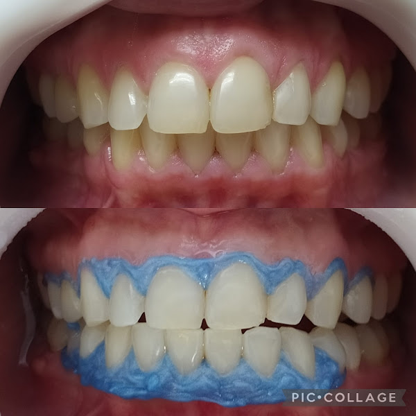 Foto 2 de COIS consultório odontológico integrado Santana