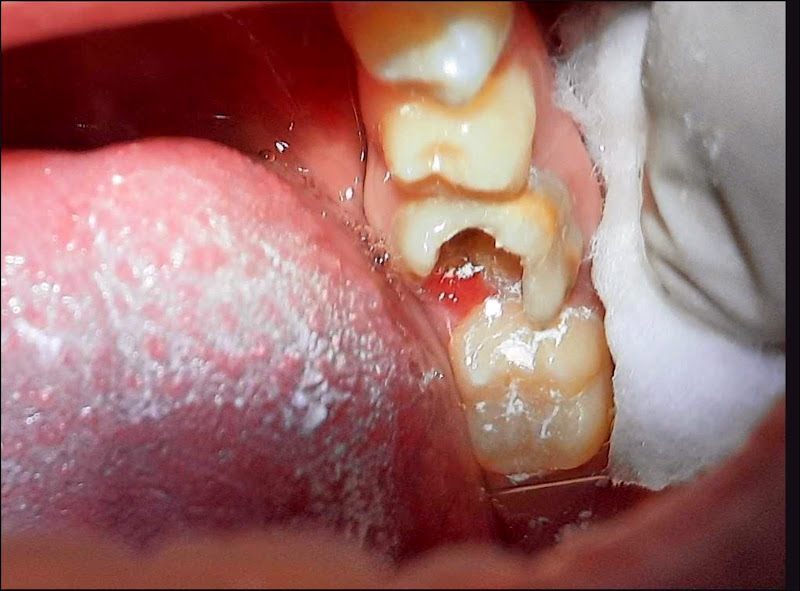 Foto 3 de COJI Clínica Odontológica
