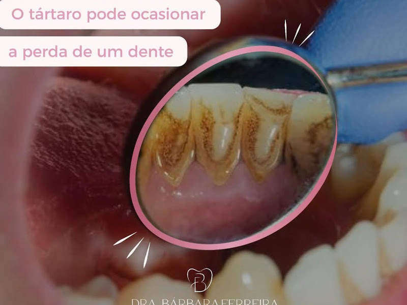 Foto 3 de COLINA QUEIROZ