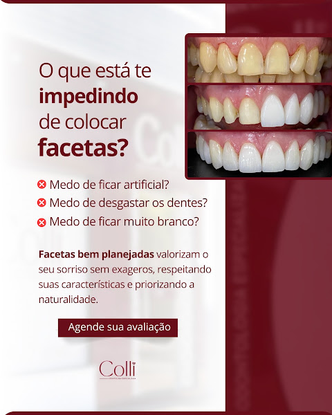 Foto 2 de Colli Odontologia Especializada | Dentista em Sarandi|RS