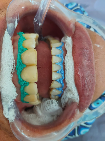 Foto 3 de Collyer Odontologia