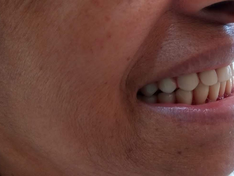 Foto 8 de Colnaghi Odontologia