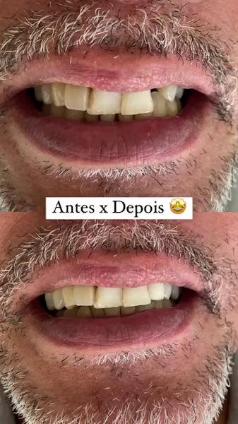 Foto 5 de Completa Odontologia - Clínica Odontológica