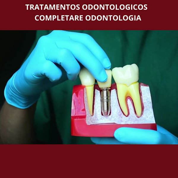 Foto 5 de Completare Odontologia