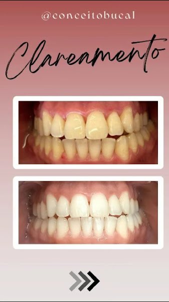 Foto 4 de Conceito Bucal | Clínica Odontológica em Canoas RS | Implantes, Aparelho e Estética