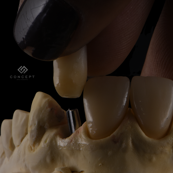 Foto 2 de Concept Ateliê Dental - Laboratório de Prótese Dentária