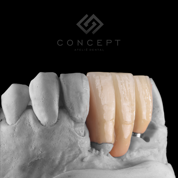 Foto 3 de Concept Ateliê Dental - Laboratório de Prótese Dentária
