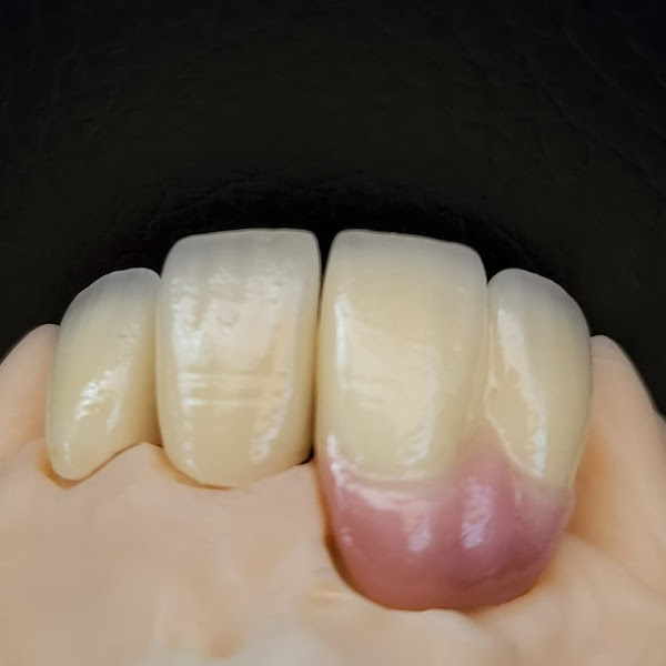 Foto 3 de Concept Lab Prótese Dental