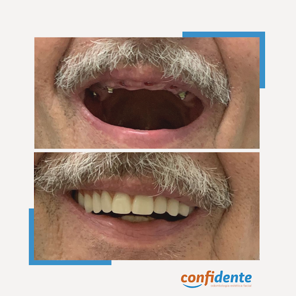 Foto 3 de Confidente Odontologia Unidade Niterói - Dentista em Canoas