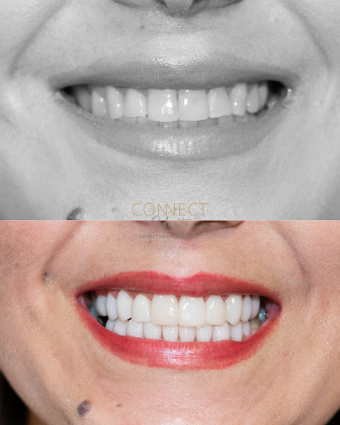 Foto 2 de ConnectOdonto Curitiba | Implante Dentário | Dentista em Curitiba PR | Clínica Odontológica