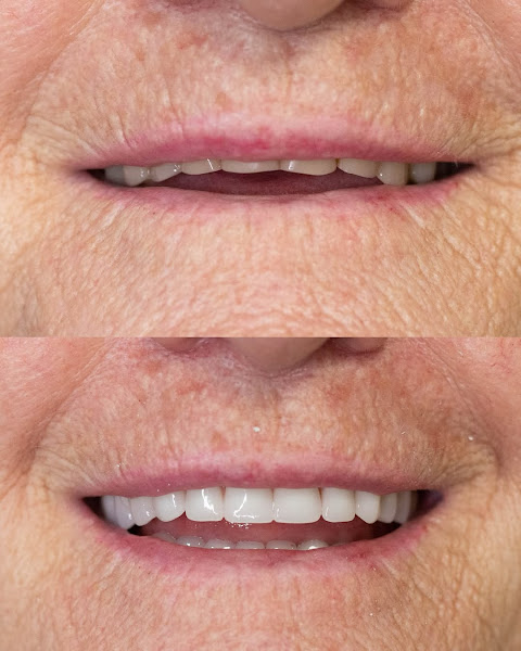 Foto 5 de ConnectOdonto Curitiba | Implante Dentário | Dentista em Curitiba PR | Clínica Odontológica