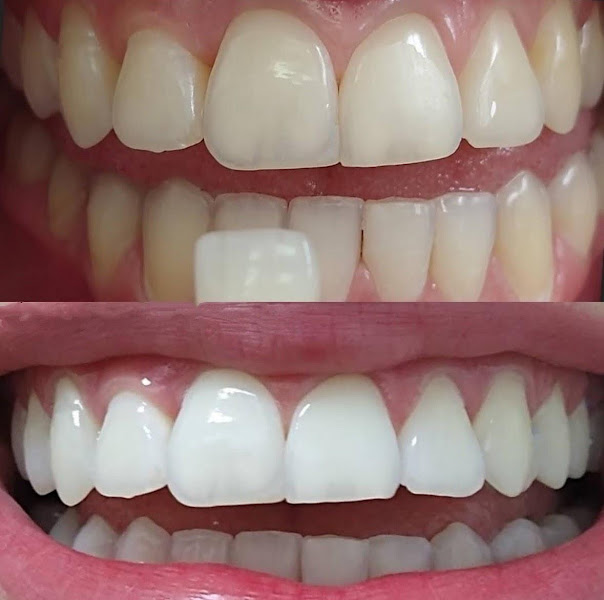 Foto 4 de Consultoral - Clínica Odontológica Itaparica Vila Velha