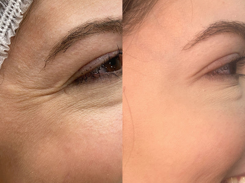 Foto 2 de Consultóri Odontologico Dr Herika B De Oliveira