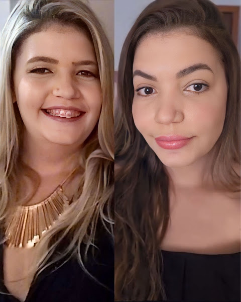 Foto 3 de Consultório Camila Conceição | Harmonização Orofacial em Salvador