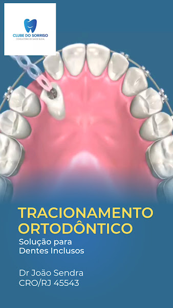 Foto 3 de Consultório Clube do Sorriso